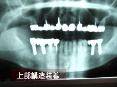 治療の経過状況